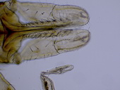 Klíště obecné (Ixodes ricinus) - samice