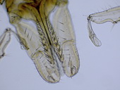 Klíště obecné (Ixodes ricinus) - samice, detail