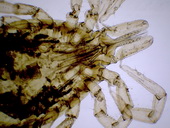 Klíště obecné (Ixodes ricinus) - samice